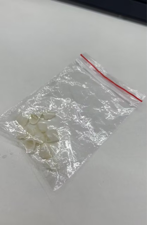 前牙临时冠