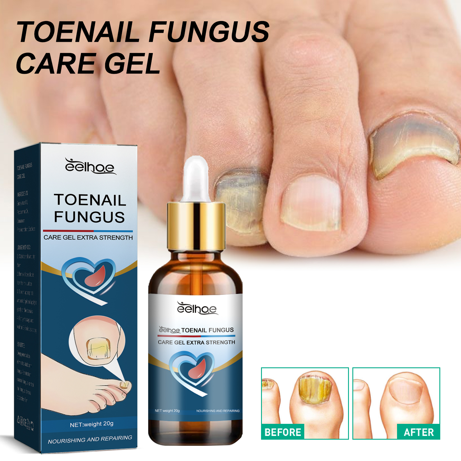 EELHOE Toenail Care Gel, Hand And Foot Nails Yellow Thickening Gray Nail Soft Nail Shine Care Gel 6