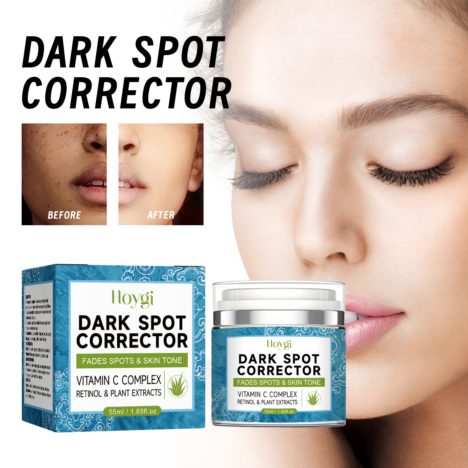 hoygi-dark-spot-lightening-cream-lightening-dark-spot-melasma-repairing-dull-and-even-skin-tone-brightening-cream hoygi-dark-spot-lightening-cream-lightening-dark-spot-melasma-repairing-dull-and-even-skin-tone-brightening-cream