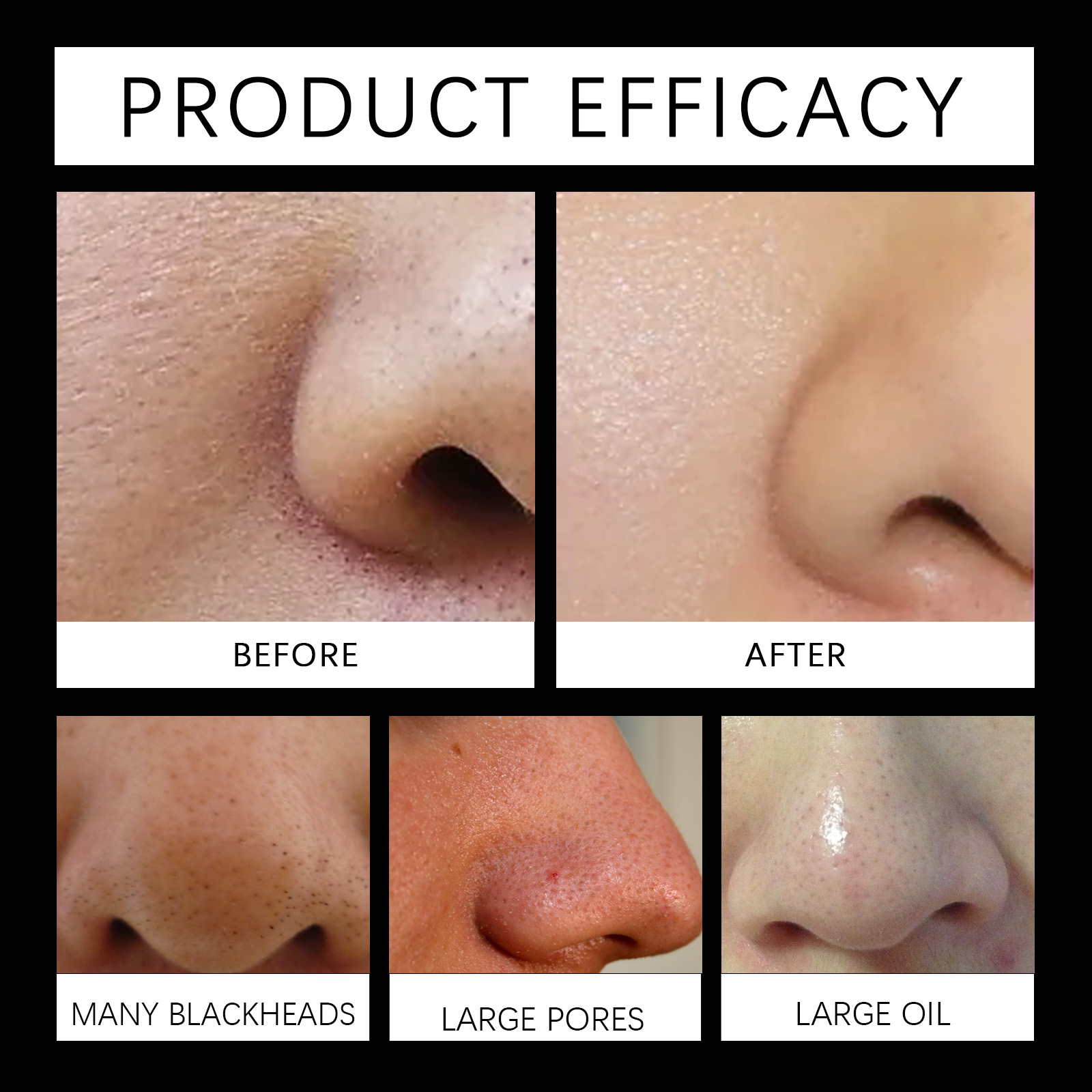 Jaysuing Charcoal Pore-Clearing Nasal Patch Clean Blackhead Acne Pore-Tightening Nasal Patch_voghion.com