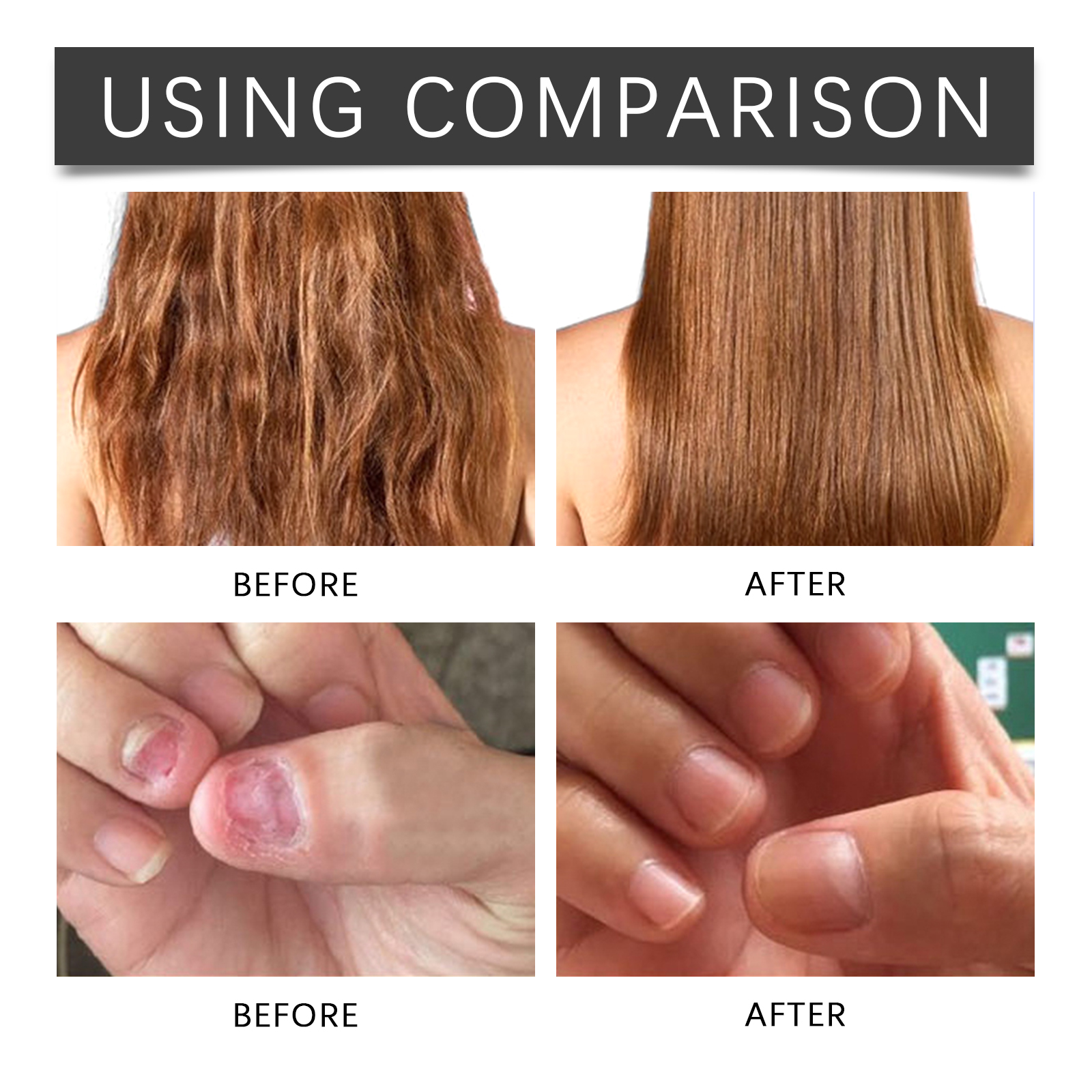 OUHOE Multi-Functional Moisturizing Essential Oil, Multi-Functional Repair And Nourishing Face, Body, Skin And Nails Aromatic Care_voghion.com