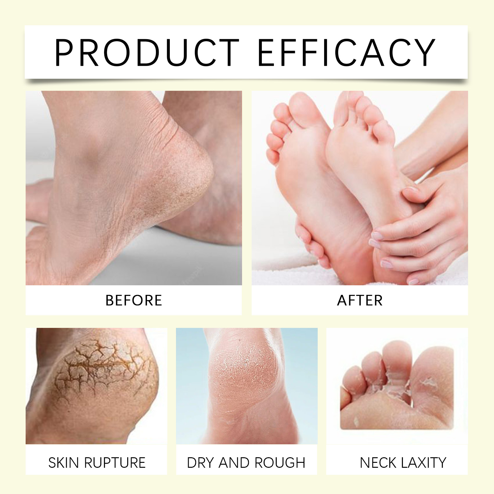 Viareline Foot Care Wax Exfoliates, Prevents Dryness, Moisturizes, Hydrates And Moisturizes Tender And Smooth Foot Skin Care Wax_voghion.com