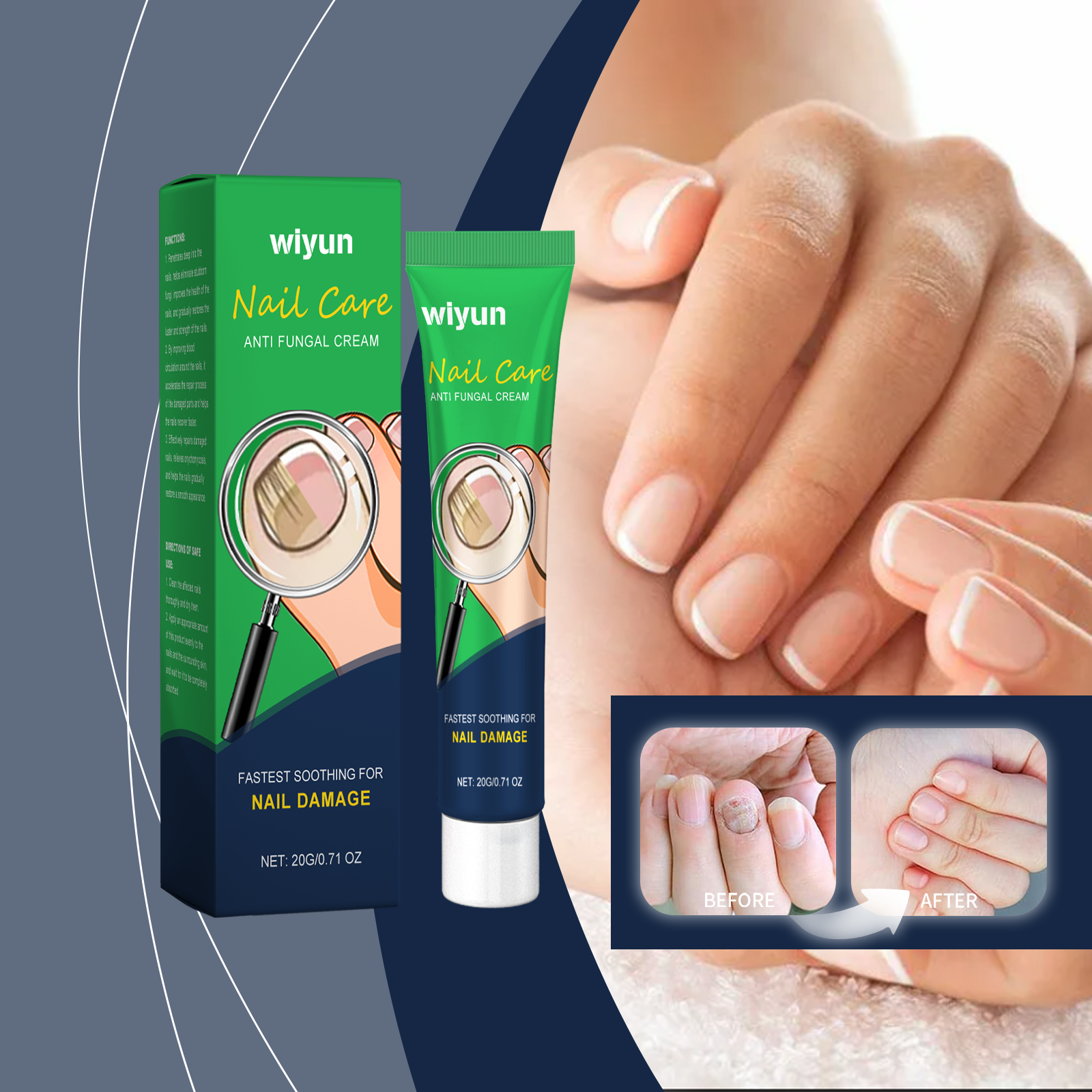 wiyun-nail-care-and-repair-cream-nourishes-nail-shine-soothes-discomfort-moisturizes-and-cleanses