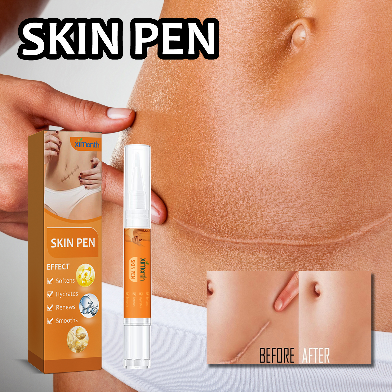 Ximonth Skin Repair Pen For Reducing Pregnancy Burns Scars And Smoothing The Skin 5