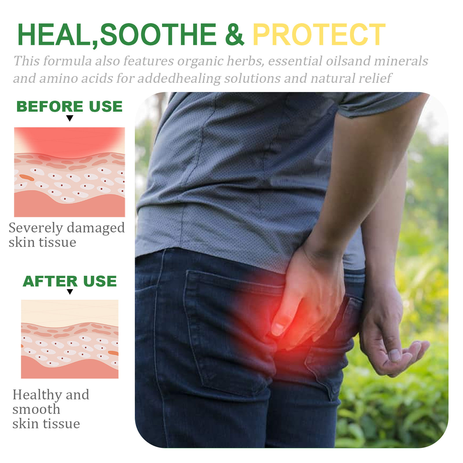 Ximonth Hemorrhoid Care Cream Relives Perianal Discomfort, Eliminates Meat Ball And Relives Hemorrhoid Anus And Relives External Herbal Care Cream 2