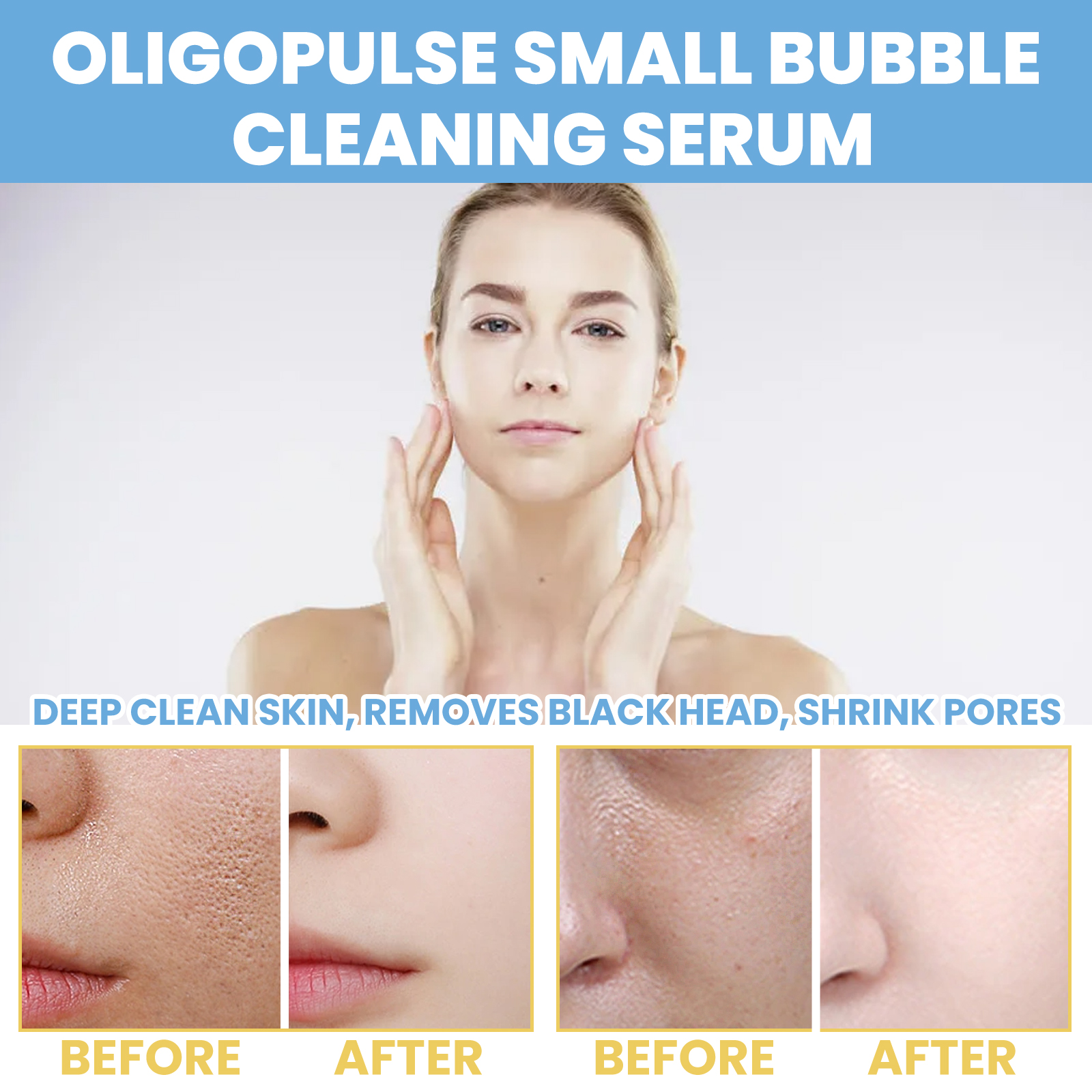 eelhoe-oligopeptide-mini-bubble-cleansing-essence-pore-tightening-skin-gentle-deep-clean-blackhead-acne