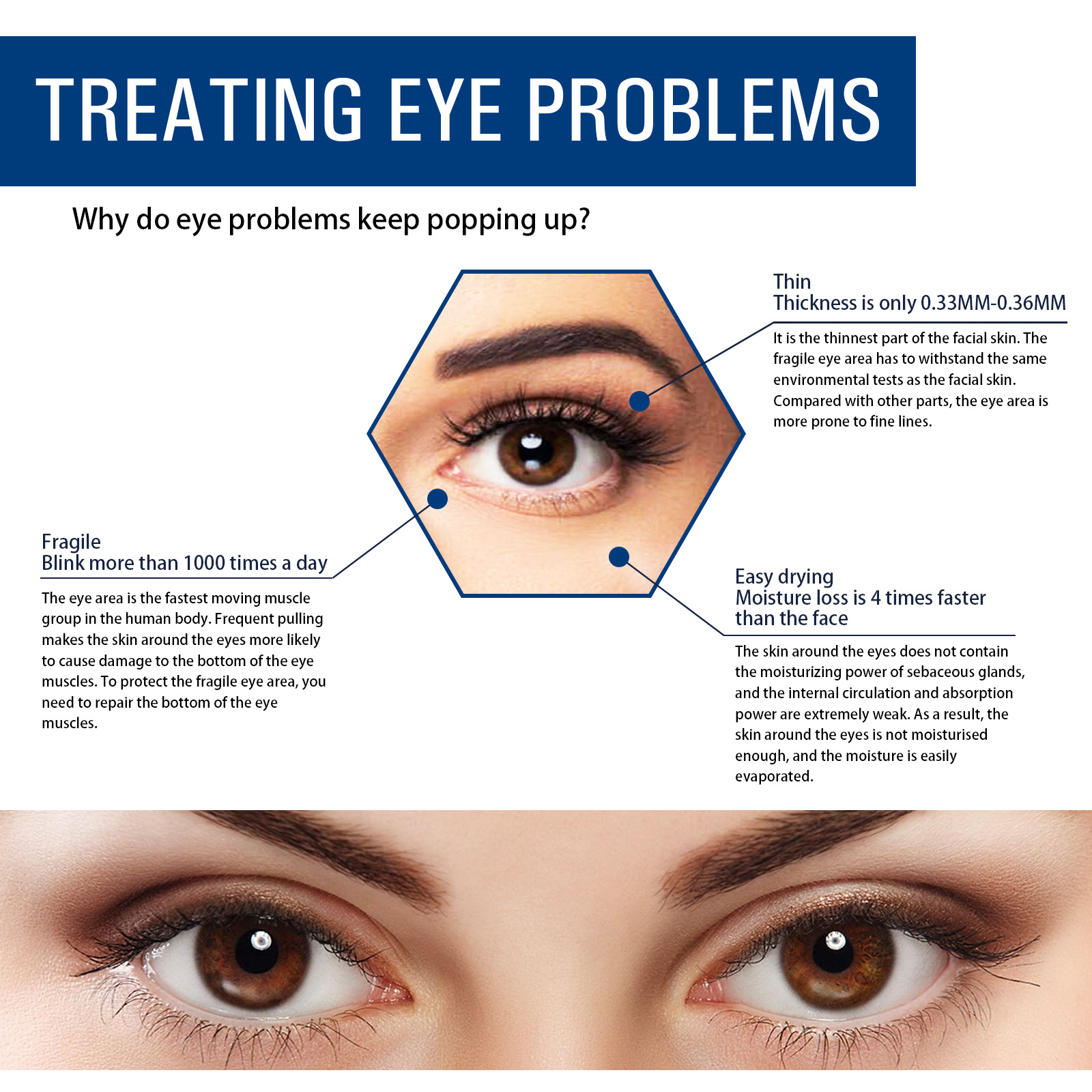 eelhoe-anti-wrinkle-eye-essence-reduces-fine-lines-dark-circles-lifts-firming-and-moisturizing-care-essence