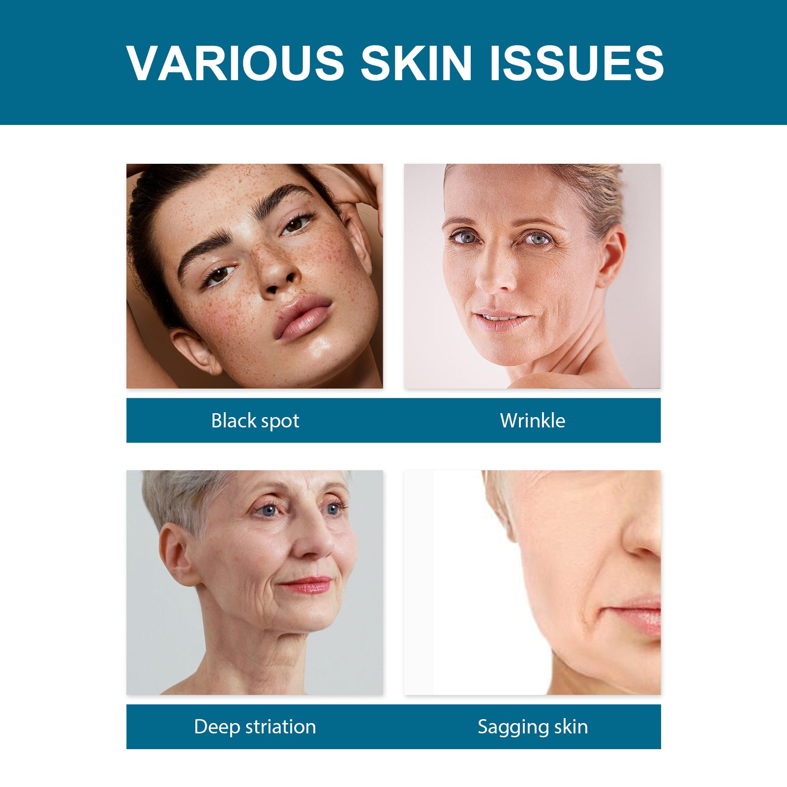 eelhoe-collagen-firming-essence-deeply-hydrates-and-tightenes-skin-with-anti-aging-collagen-recombination