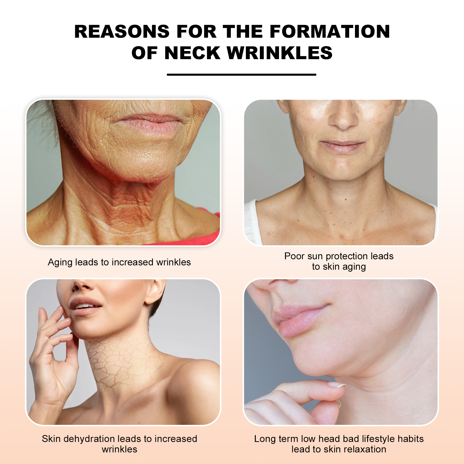 eelhoe-retinol-anti-wrinkle-neck-cream-lighten-neck-lines-moisturizing-hydrating-firming-and-brightening-skin-neck-cream eelhoe-retinol-anti-wrinkle-neck-cream-lighten-neck-lines-moisturizing-hydrating-firming-and-brightening-skin-neck-cream