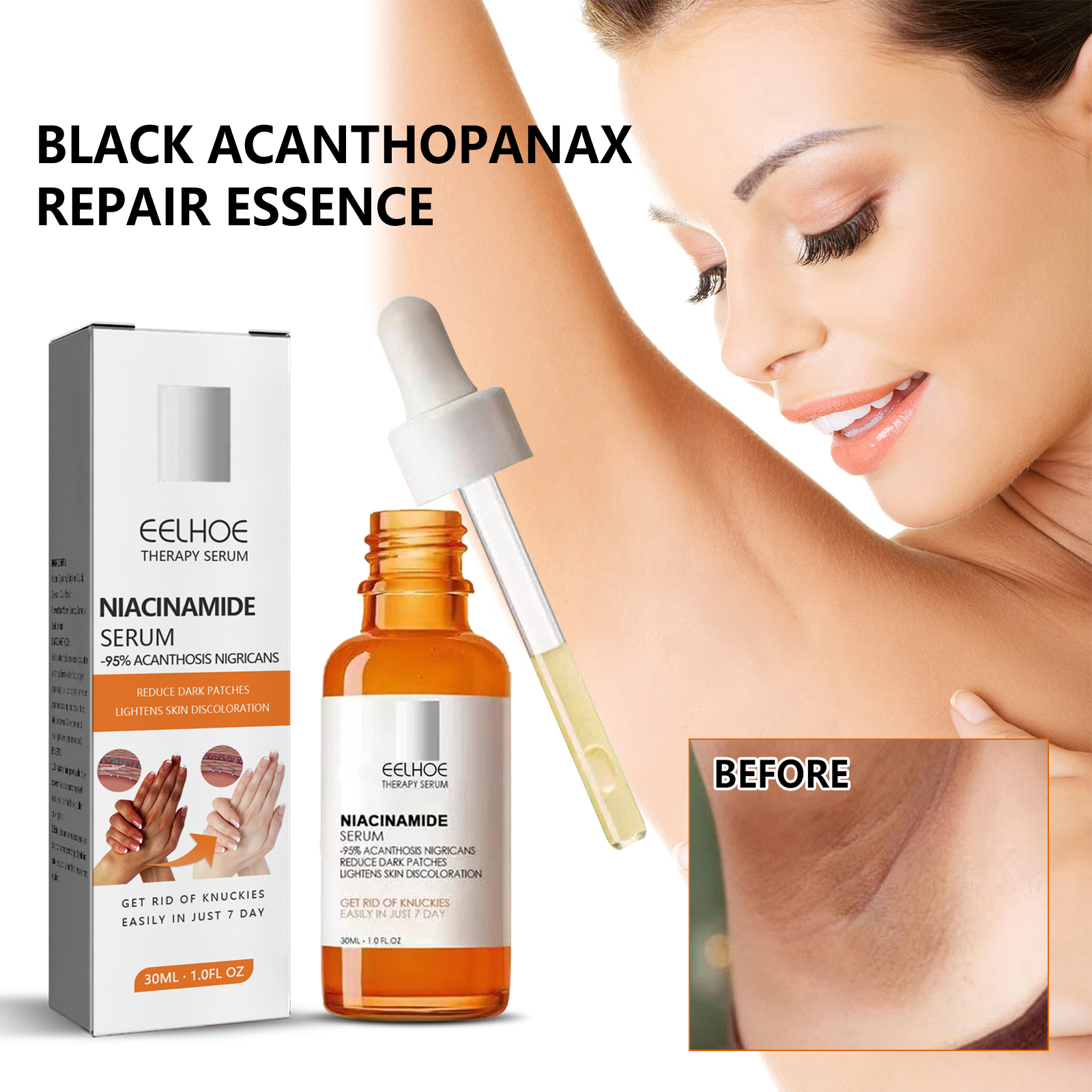 eelhoe-acanthosis-nigricans-repair-essence-brightening-skin-repair-skin-beauty-essence-underarm-joint-black-whitening