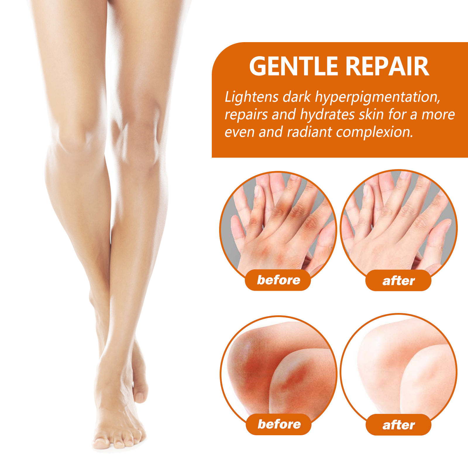 eelhoe-acanthosis-nigricans-repair-essence-brightening-skin-repair-skin-beauty-essence-underarm-joint-black-whitening