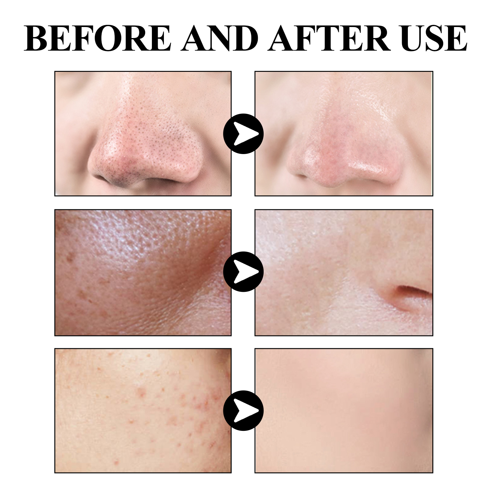 EELHOE Blackhead Removal Mask Deeply Cleanses Pores, Lightening Blackheads, Oil Control And Moisturizing Smear Peel Mask_voghion.com