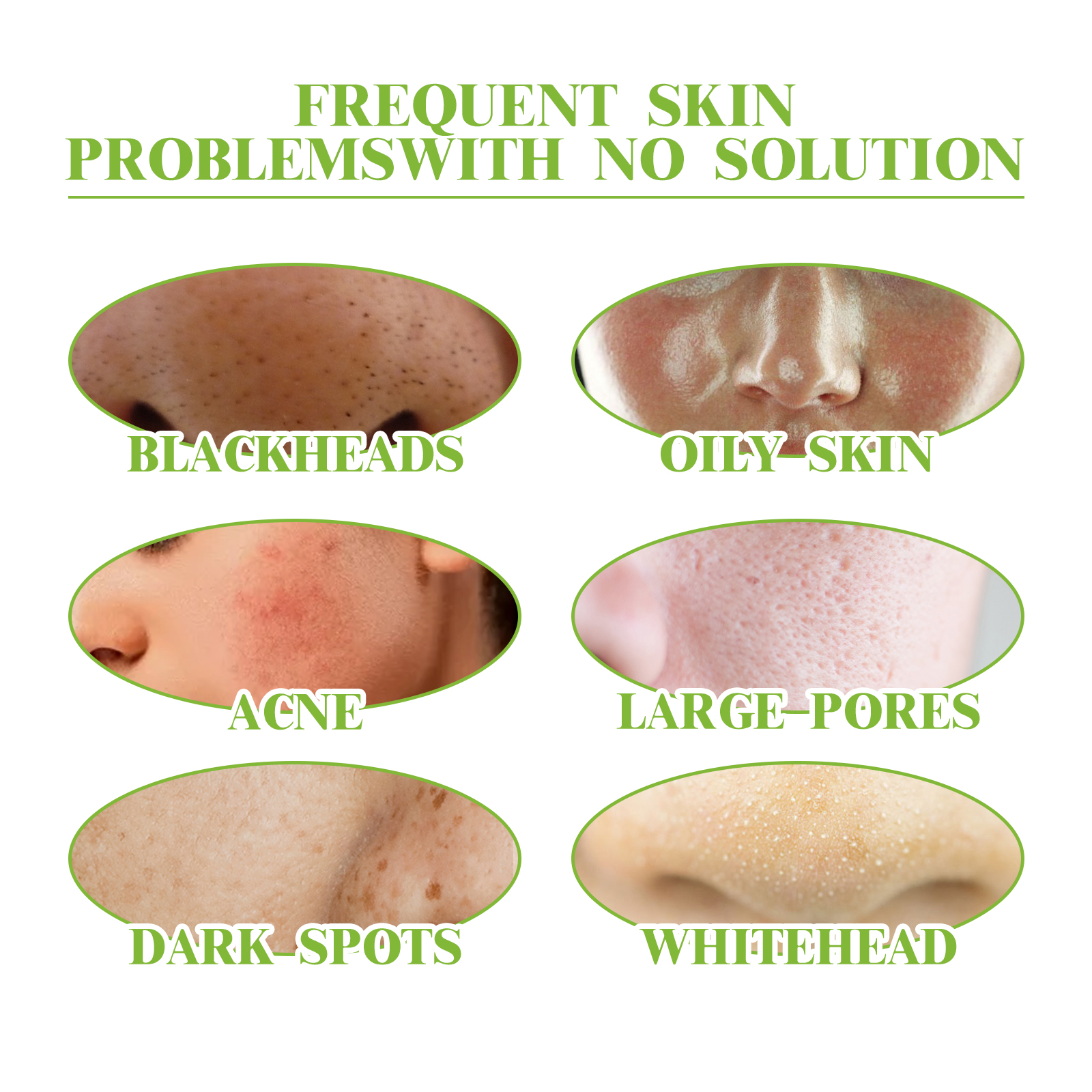 eelhoe-green-tea-cleansing-mousse-a-deep-cleansing-facial-cleanser-with-refreshing-oil-control-and-wrinkles-reduction