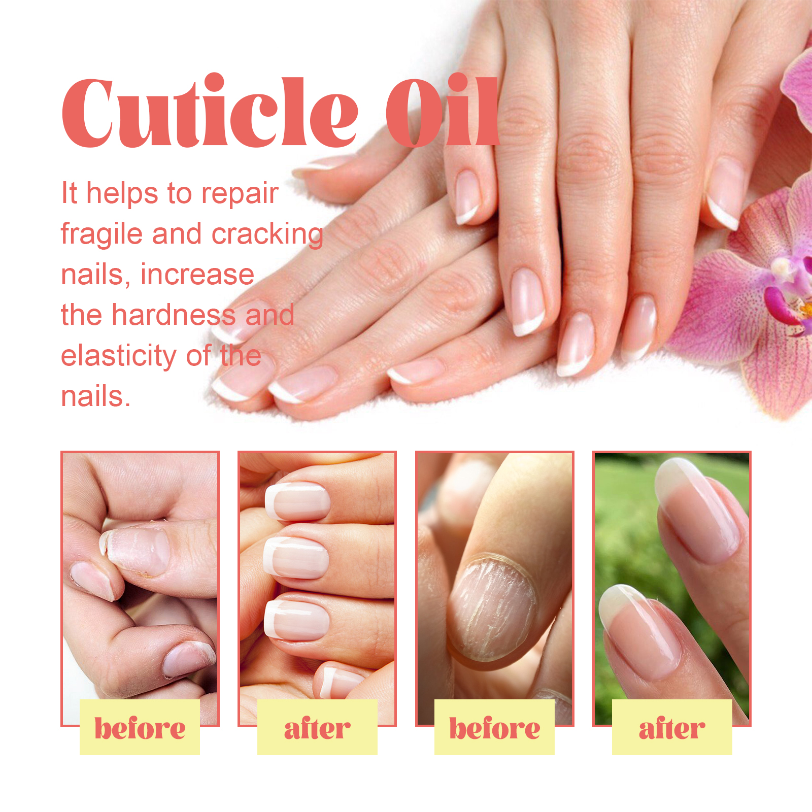 eelhoe-cuticle-oil-repair-dry-rotted-nails-thickening-moisturizing-care-brightening-nails-and-cleaning eelhoe-cuticle-oil-repair-dry-rotted-nails-thickening-moisturizing-care-brightening-nails-and-cleaning