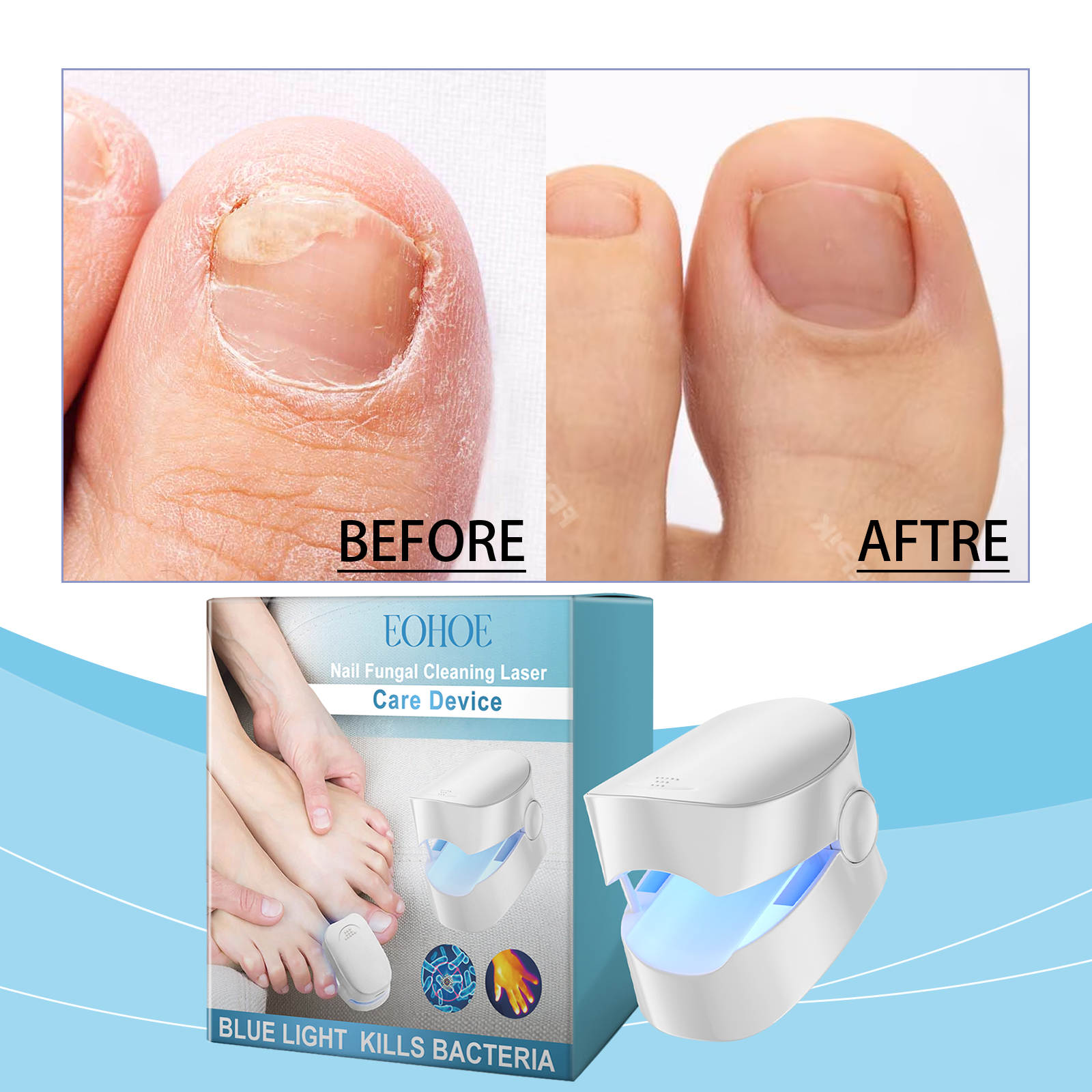 eohoe-nail-care-nail-cleaning-care-to-relieve-discomfort-on-the-foot-of-the-nail-smooth-rough-surface-of-the-nail