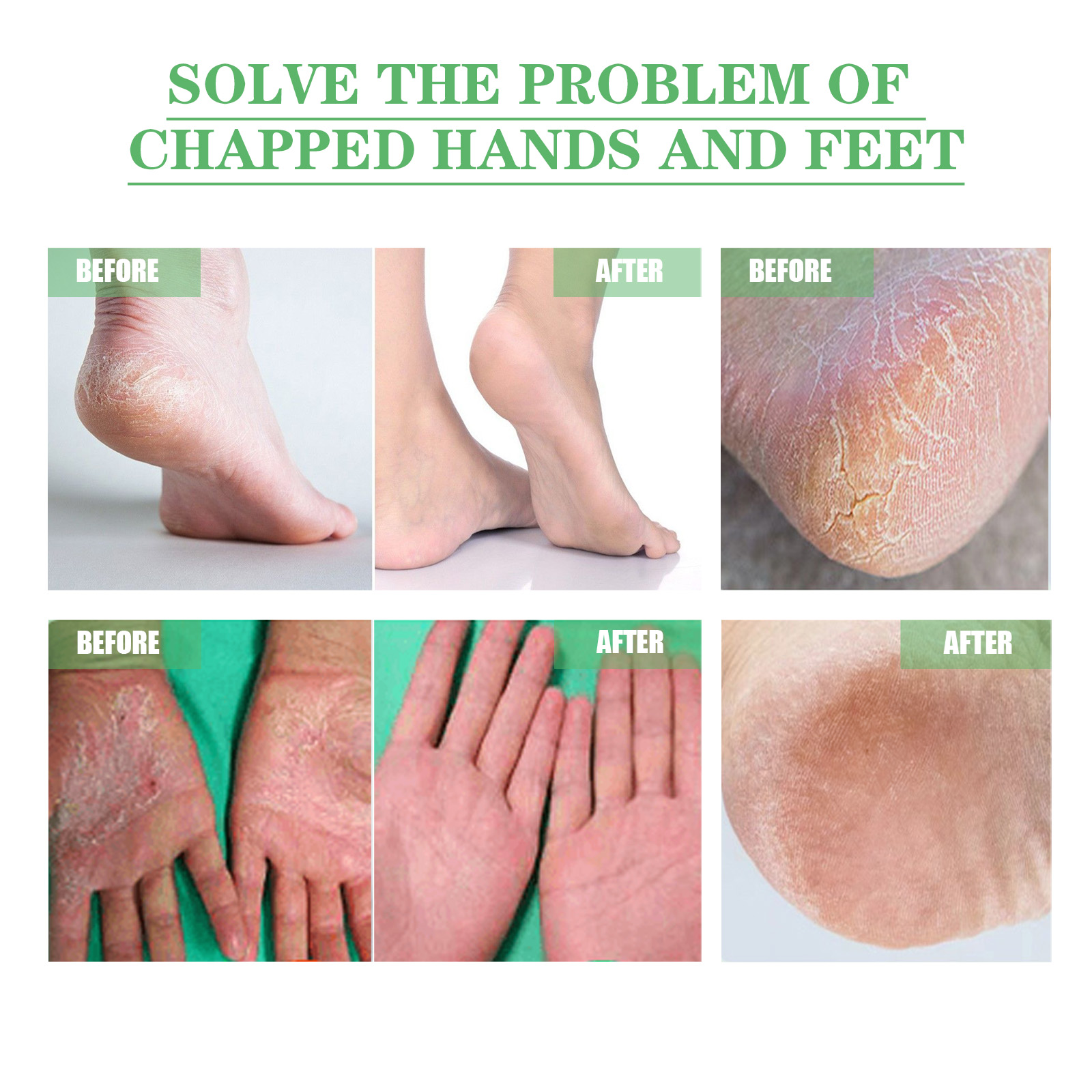 eelhoe-dry-crack-protection-moisturizing-cream-moisturizing-and-hydrating-hand-and-foot-repair-skin-care-cream