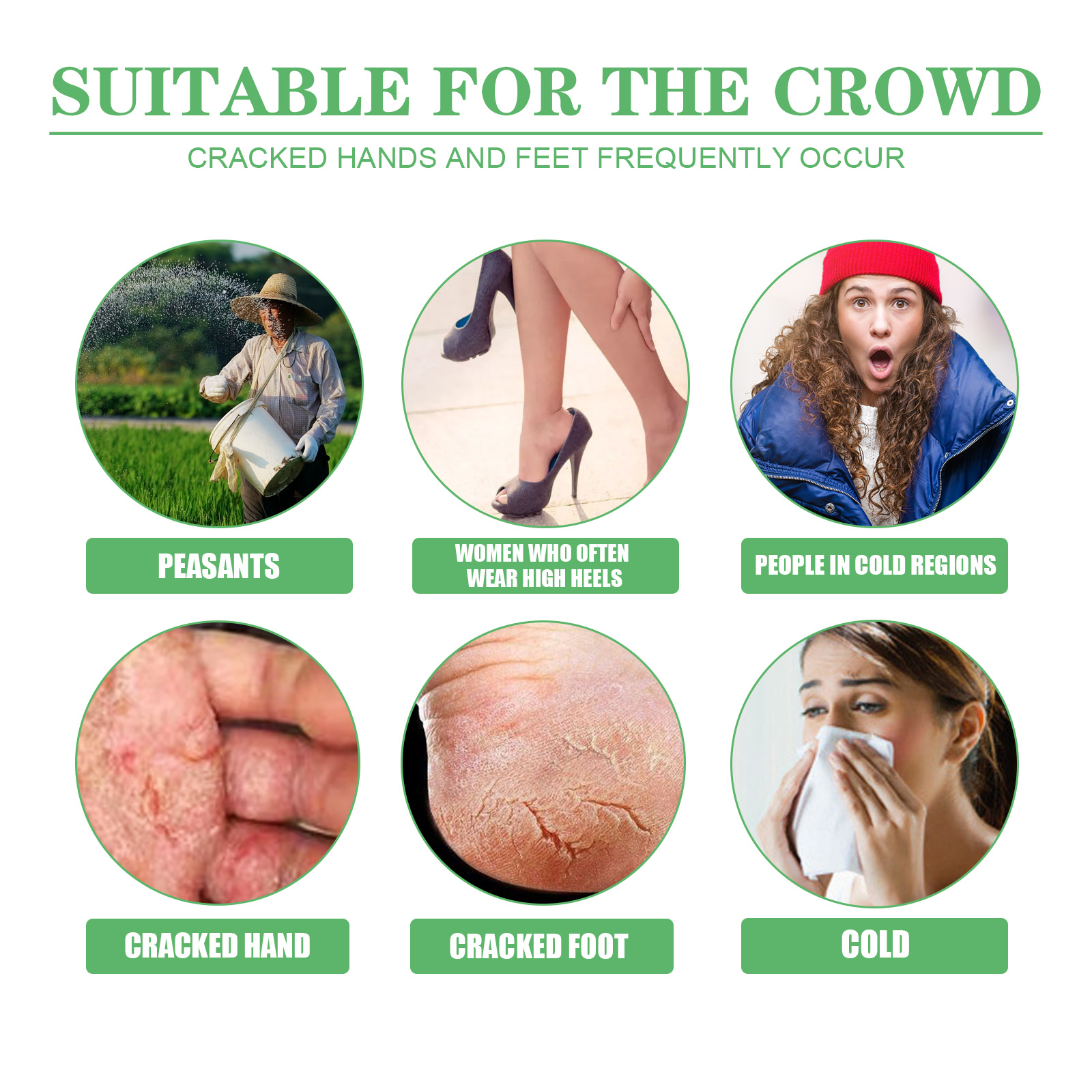 eelhoe-dry-crack-protection-moisturizing-cream-moisturizing-and-hydrating-hand-and-foot-repair-skin-care-cream