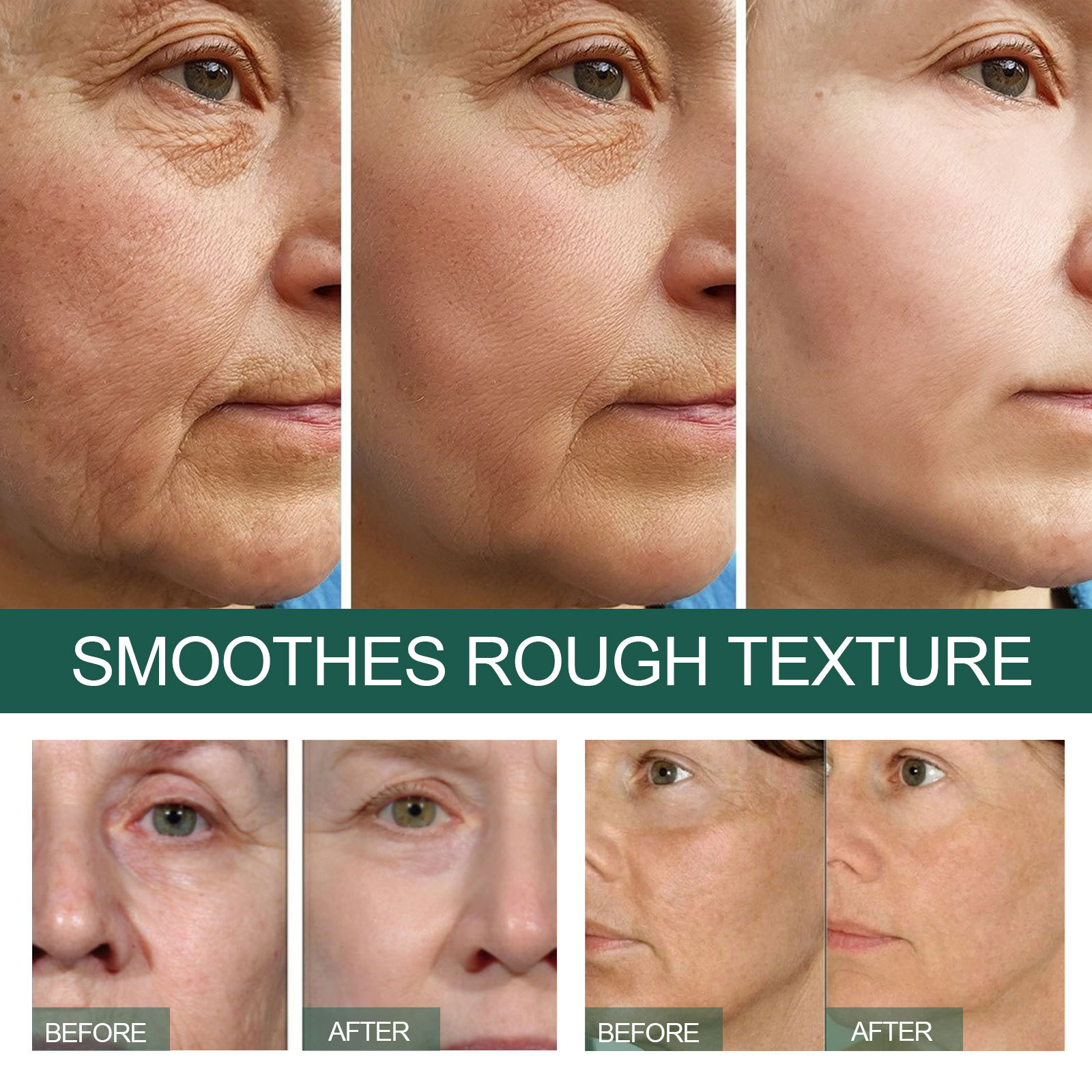 eelhoe-deep-anti-wrinkle-serum-lighten-fine-lines-and-dark-circles-under-the-eyes-tighten-and-adjust-skin-tone-moisturize-skin-care