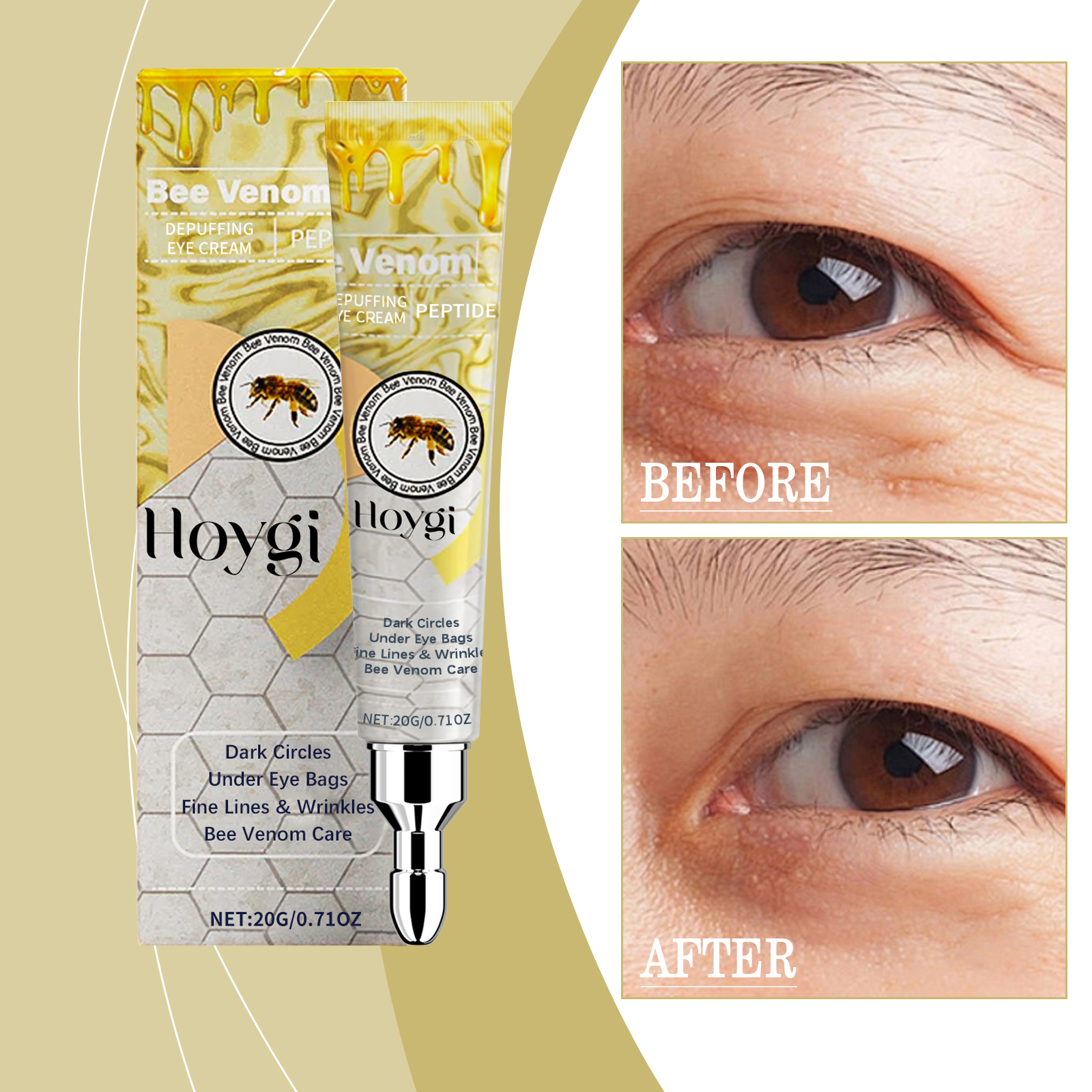 hoygi-bee-venom-eye-cream-gently-hydrates-and-moisturizes-the-skin-around-the-eyes-to-improve-elasticity