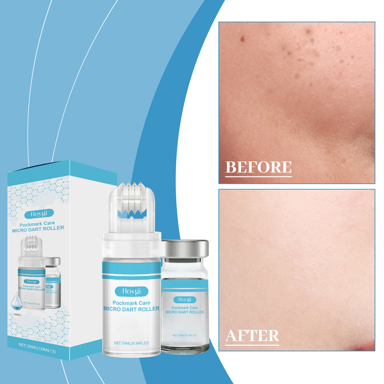 hoygi-hyaluronic-acid-essence-moisturizing-and-enhancing-skin-shine-daily-skin-care-facial-roller-essence