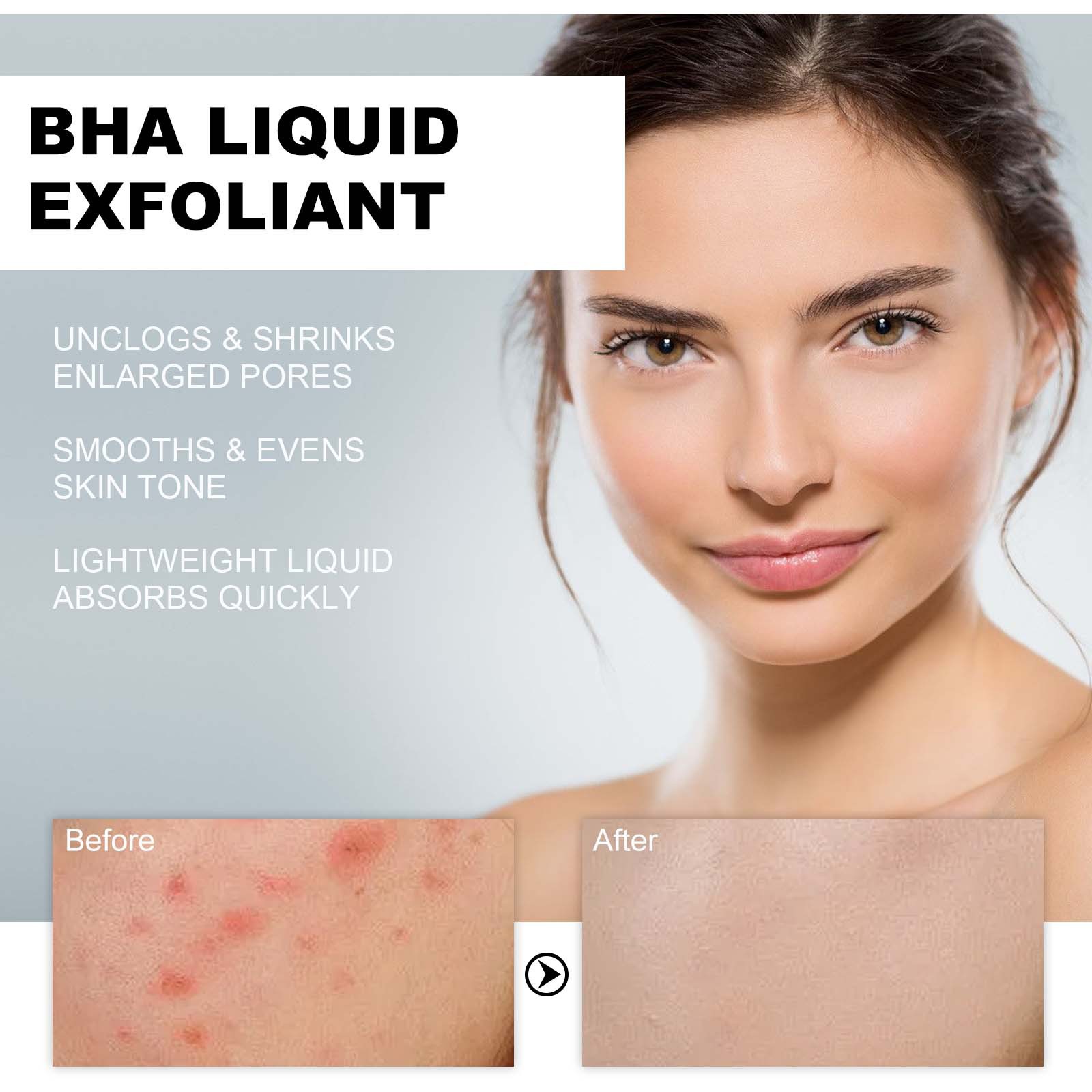 hoygi-bha-liquid-exfoliant-lightening-acne-seal-pore-tightening-and-moisturizing-skin-essence