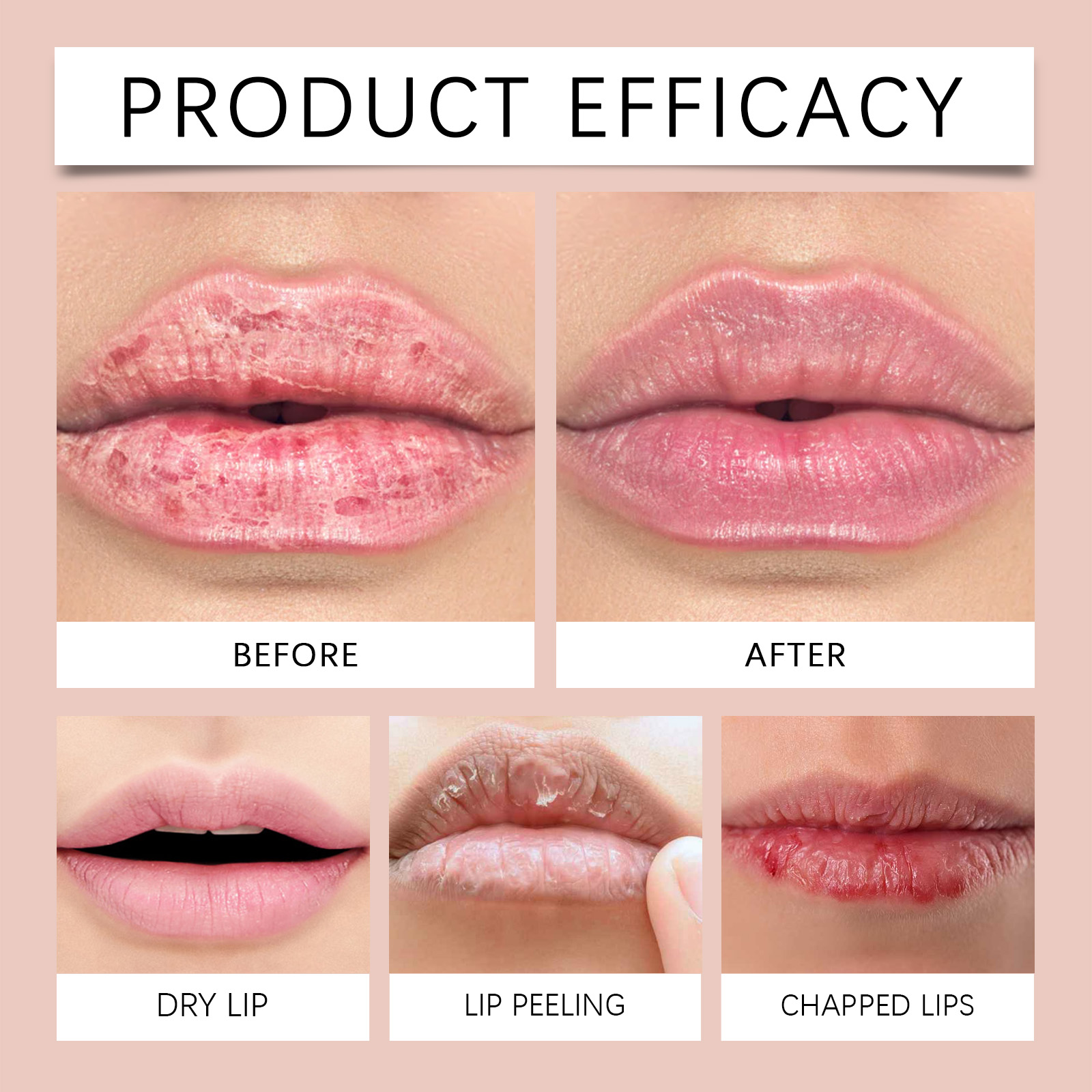 Hoygi Strawberry Lip Mask, Lighten Lip Lines And Gently Moisturize Lips, Remove Dead Skin And Moisturize Lips_voghion.com