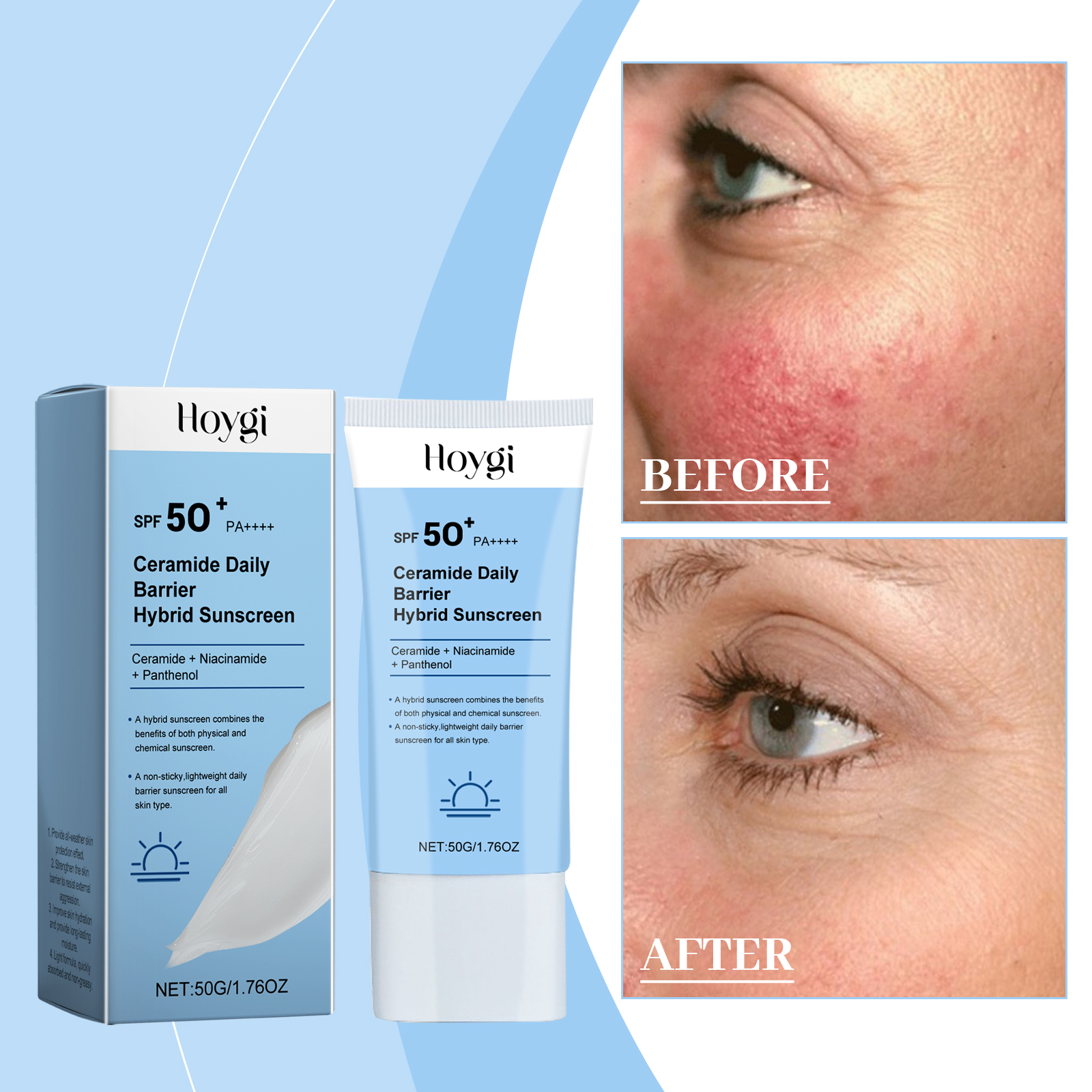 Hoygi Ceramide Protective Cream, Refreshing And Moisturizing In Summer, Protects Skin, Restores Uv Isolation And Prevents Sweat_voghion.com