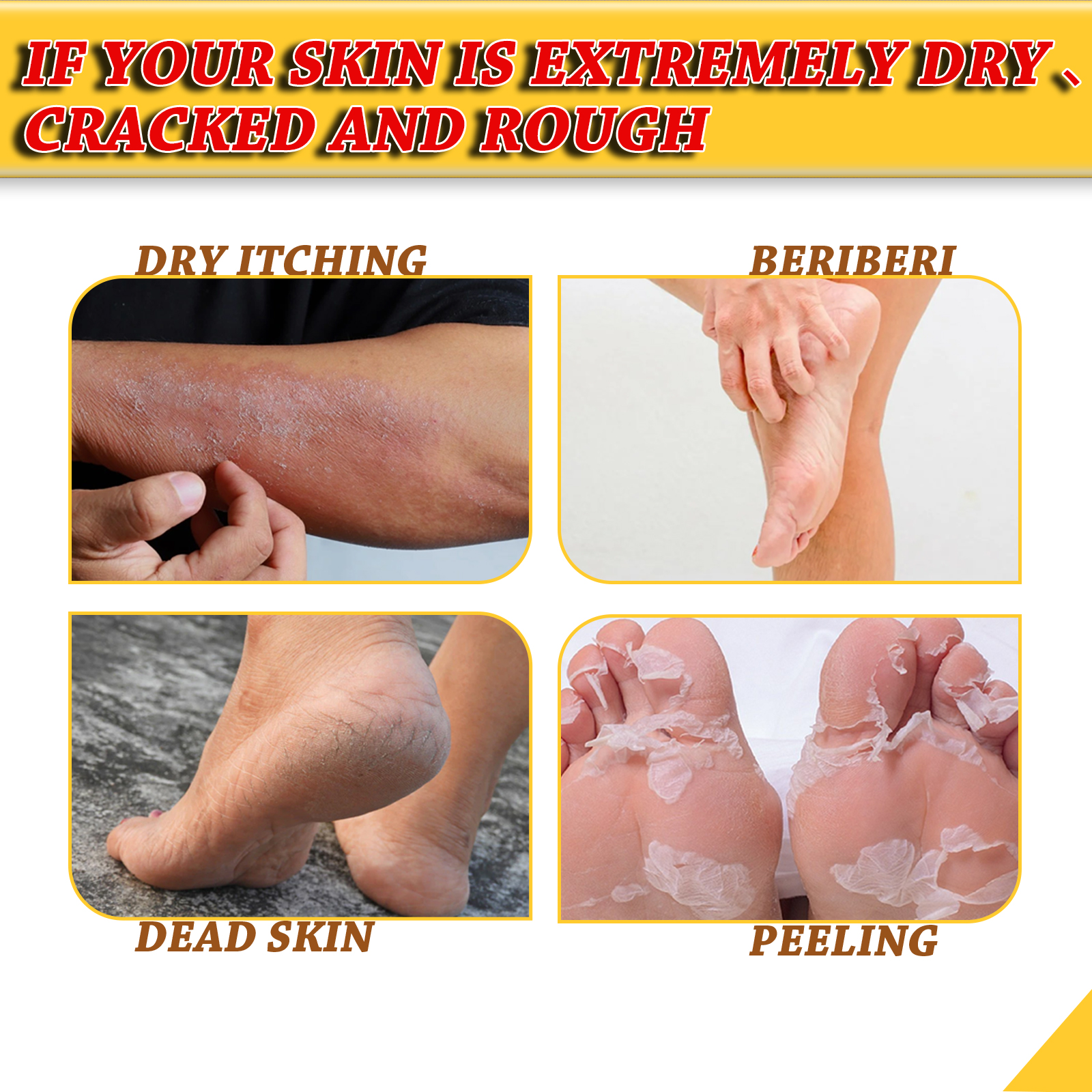 jaysuing-foot-repair-cream-moisturizes-skin-to-prevent-skin-cracking-dry-and-itchy-foot-care-and-repair-cream