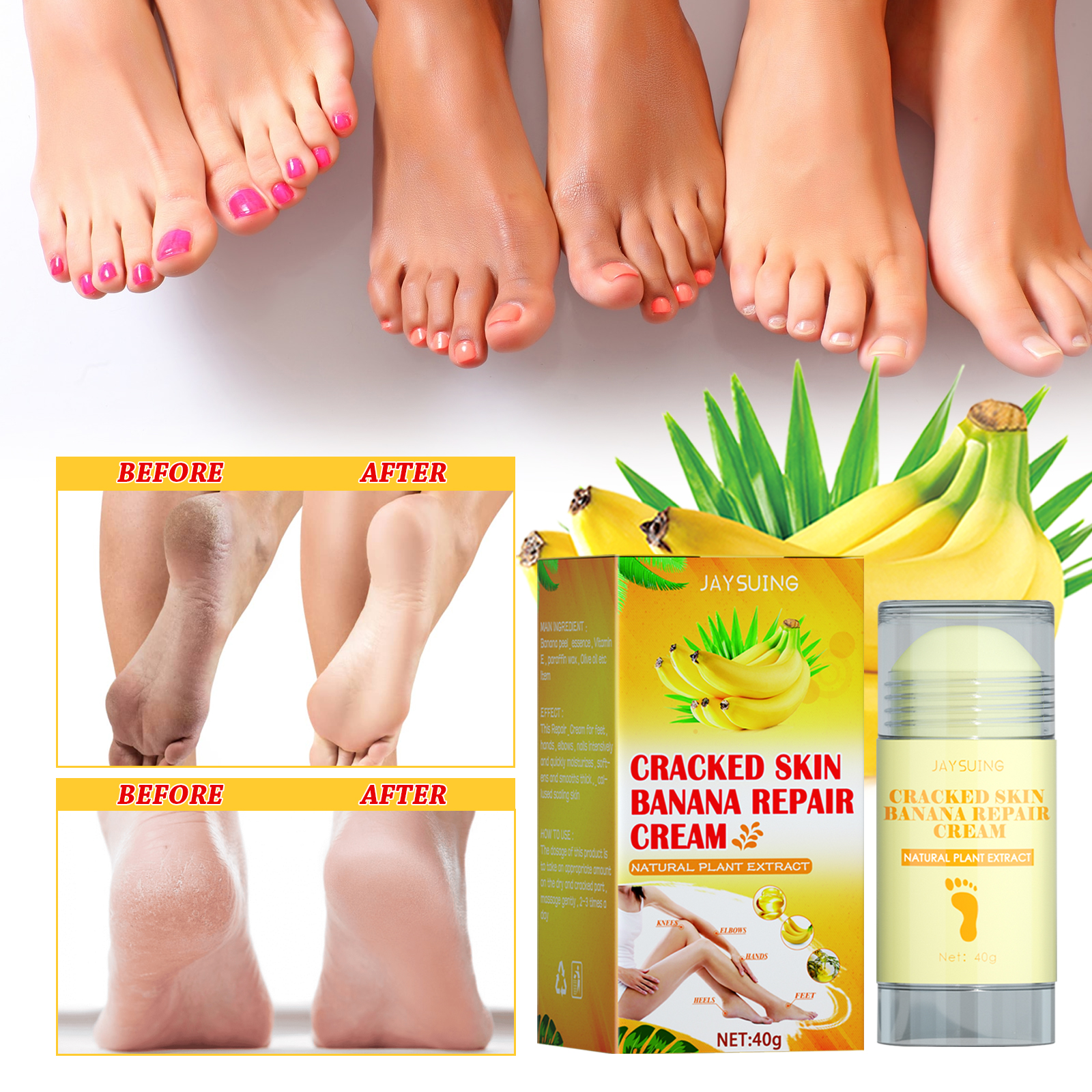 jaysuing-foot-repair-cream-moisturizes-skin-to-prevent-skin-cracking-dry-and-itchy-foot-care-and-repair-cream