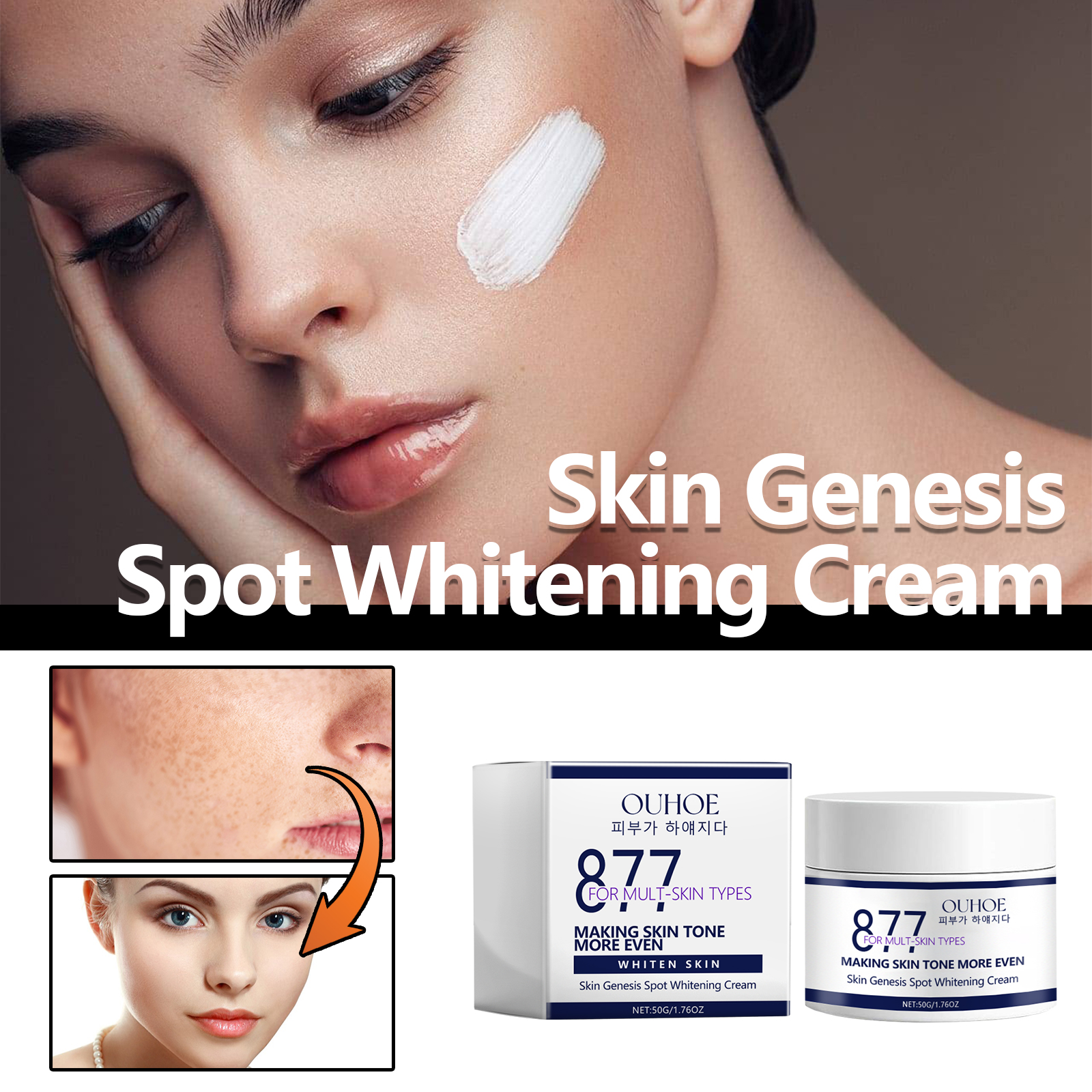 ouhoe-skin-genesis-spot-whitening-cream-moisturizing-and-rejuvenating-skin-whitening-body-skin-care-cream