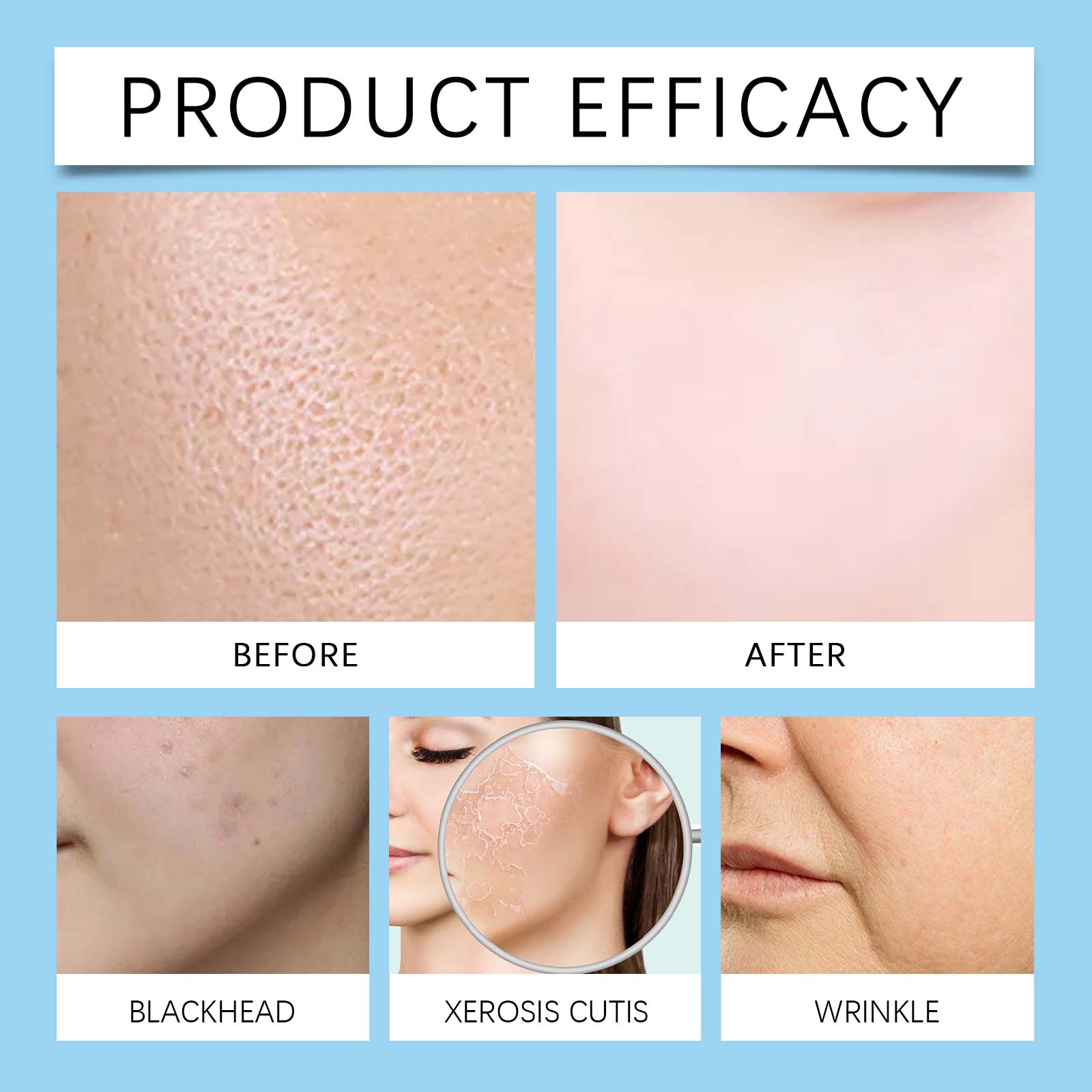 ouhoe-hyaluronic-acid-face-serum-facial-gentle-nourishing-and-moisturizing-improve-skin-texture