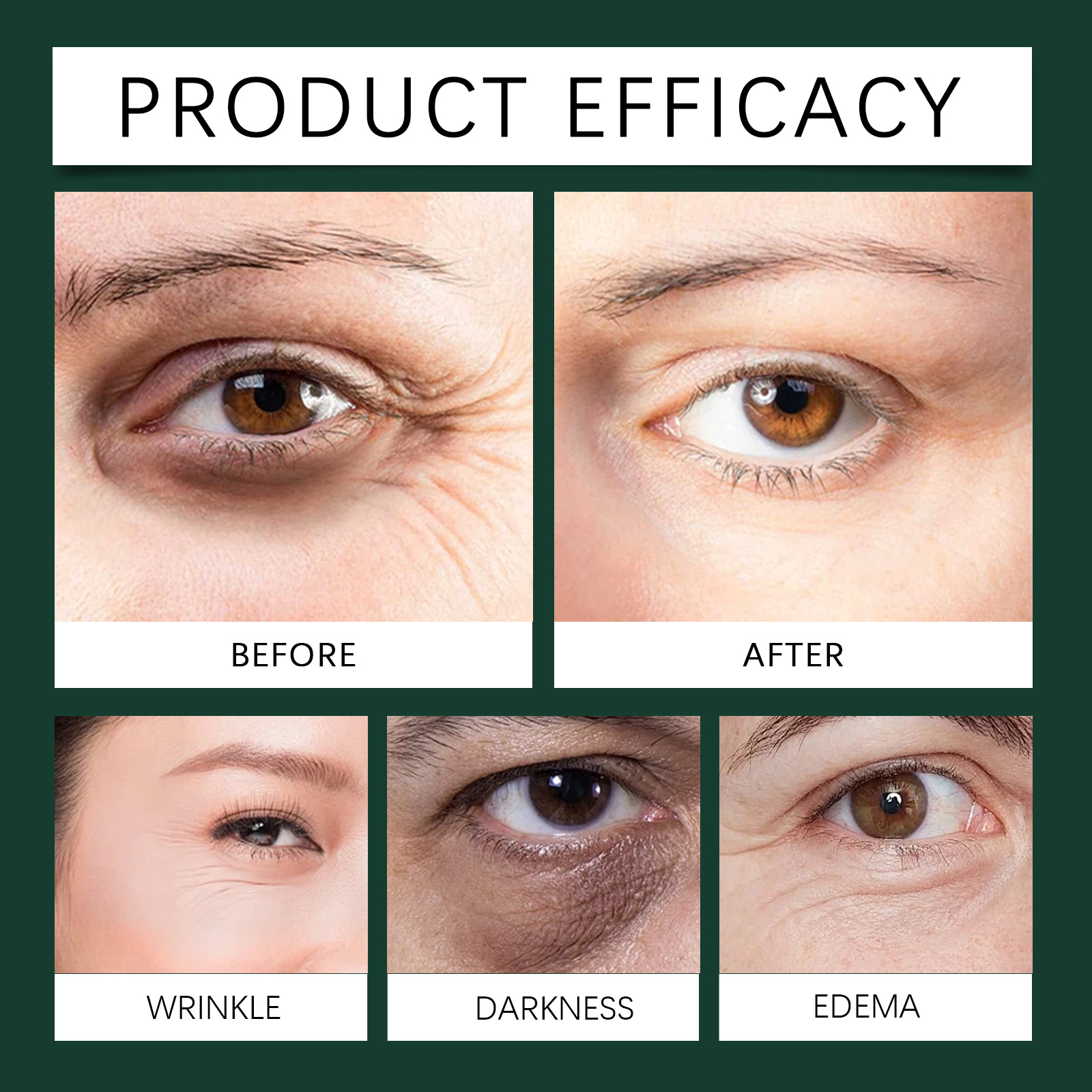 ouhoe-mint-essence-eye-roller-fade-fine-lines-crows-feet-moisturizing-elastic-eye-anti-wrinkle