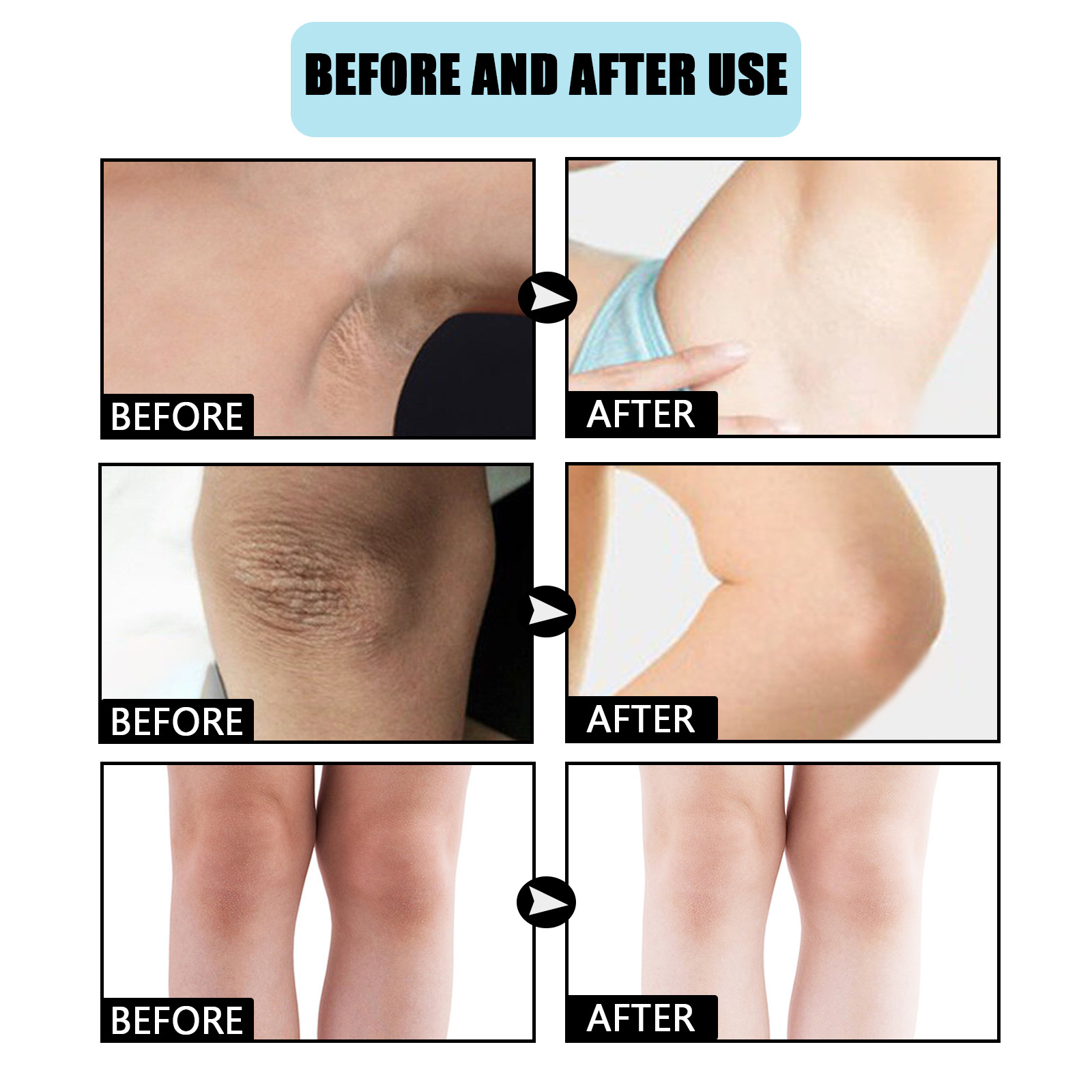 eelhoe-brightening-cream-moisturizing-knee-elbow-concealer-moisturizing-delicate-and-brightening-body-lotion